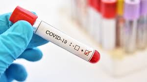 4382 нови случая на коронавирус при направени 10 474 PCR теста